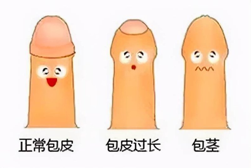 前列腺病是什么原因引起的?这是一个困扰着许多男性朋友的难题。今天,我们就来揭开这个谜团。